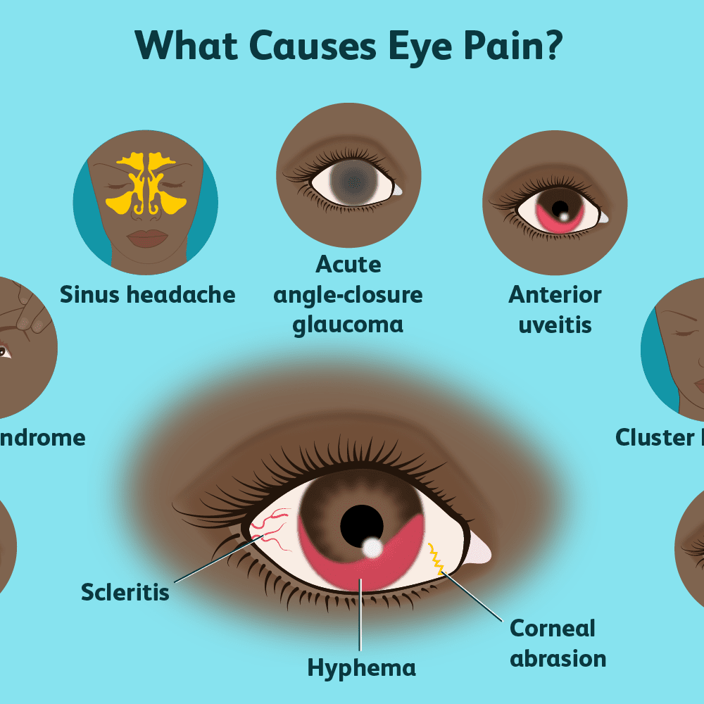 5 Tips To Permanently Cure Eye Pain